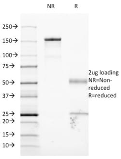ICAM-1/CD54 Antibody (W-CAM-1 (same as Wehi-CAM-1 or 1H4)), Novus Biologicals